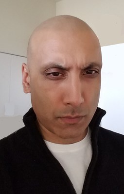 Learn Why Weight Loss Must Be as Easy as Weight Gain  Image