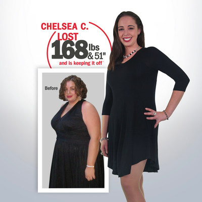 Chelsea C Before & After 168 lbs weight loss