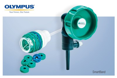 Olympus announced today its exclusive distribution agreement with Intelligent Endoscopy. Beginning immediately, SmartBand® Multi-Band Ligation Kit, cleared by the FDA to endoscopically ligate esophageal varices at or above the gastroesophageal junction and internal hemorrhoids, will be distributed by Olympus America Inc. (OAI). SmartBand offers the first scientifically designed anti-slip, latex-free bands to provide needed gripping force to treat esophageal varices.