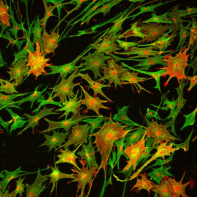 This image from a paper in Nature Medicine shows how inhibiting an enzyme called HDAC3 in mice increases the expansion of Schwann cells (green). Schwann cells form a protective insulating layer called the myelin sheath around the nerves. Blocking HDAC3 increases the production of myelin proteins, shown in red. Scientists from Cincinnati Children's tested an experimental molecular therapy in the mice that restored nerve insulation and improved limb function following nerve injury.