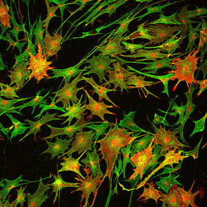 Experimental Therapy Restores Nerve Insulation Damaged by Disease