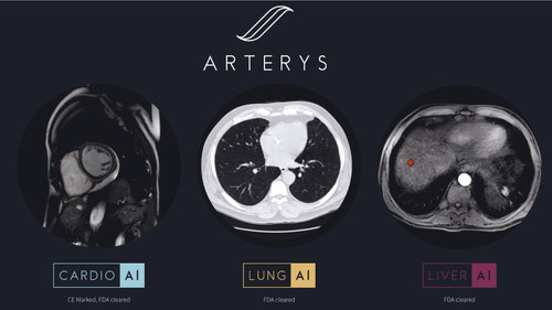 Arterys expands its clinical offerings with two new AI-powered workflows for medical imaging interpretation