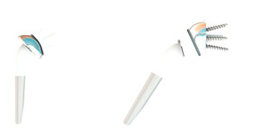 Opening of FX Shoulder USA: the French Shoulder Arthroplasty Specialist