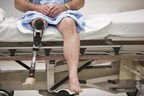 US Drug Watchdog Now Urges a Person Who Had a Below the Knee Amputation After Using the Diabetes Drug Invokana to Call Them About Possible Compensation That Could Be $500,000 or More