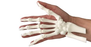 Stoke Med to Provide Patient Specific 3D-Printed Models