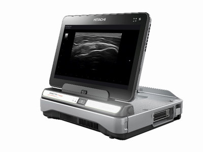 https://mma.prnewswire.com/media/646792/Hitachi_Ultrasound_ARIETTA.jpg?p=caption