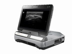 Hitachi Medical Systems Europe Announces "ScanSync" - a New Function for Diagnostic Ultrasound That Reduces the Burden on Operators - Which Is to Be Supported by the "ARIETTA Prologue"