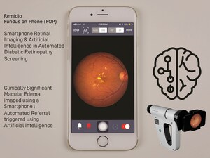 Smartphone-based Retinal Imaging Together With Artificial Intelligence Powers Automated, Sensitive and Early Detection of Retinopathy