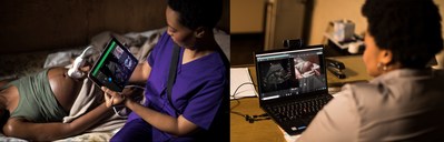 Lumify with Reacts brings experts into an ultrasound exam, no matter the distance, allowing a midwife in a remote location to call upon an obstetrician to provide perspective and guidance as though they were in the same room.