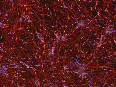 Neurons directly differentiated from iPSCs, day 5