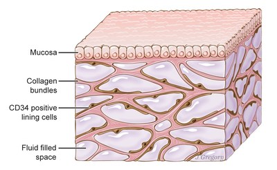 A newfound organ, the interstitium, is seen here beneath the top layer of skin, but is also in tissue layers lining the gut, lungs and urinary systems, as well as those surrounding blood vessels and the fascia between muscles. The organ is a body-wide network of interconnected, fluid-filled compartments that may keep tissues from tearing as they flex. Illustration by Jill Gregory. Printed w/ permission from Mount Sinai Health System, licensed under CC-BY-ND.