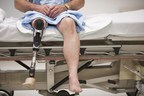 US Drug Watchdog Now Urges a Person Who After Using the Type Two Diabetes Medication Invokana Suffered a Below the Knee-leg Amputation to Call About Financial Compensation That Could Exceed $500,000