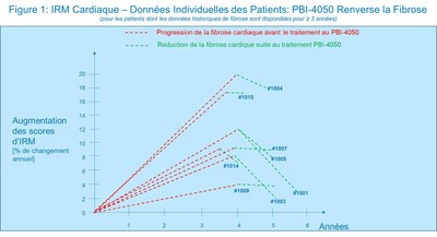 Figure 1 : IRM Cardiaque - Données Individuelles des Patients : PBI-4050 Renverse la Fibrose (Groupe CNW/ProMetic Sciences de la Vie Inc.)