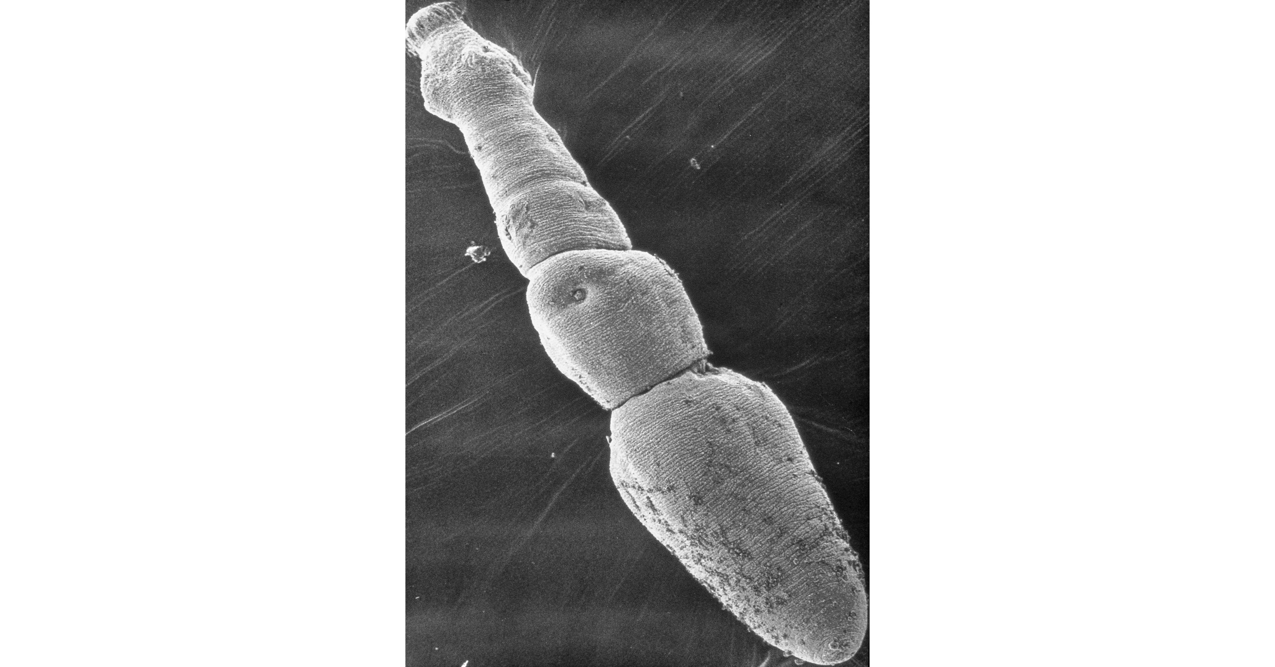 echinococcus-multilocularis-an-emerging-threat