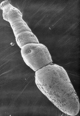 Lgende : Micrographe lectronique de Echinococcus multilocularis, galement connu sous le nom de tnia du renard (Groupe CNW/Institut canadien de la sant animale)