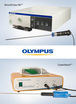 Olympus Announces Intention to Acquire Lithotripsy Systems from Cybersonics, Inc.