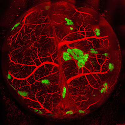 This image shows robustly vascularized pancreatic islets (green areas) bioengineered by researchers and transplanted into a mouse.  The bioengineered islets?which have a network of blood vessels (shown in red) and secrete hormones like insulin?are shown seven days after transplant. Scientists reporting research data in Cell Reports say their goal is to one day translate the bioengineering process to human patients with diabetes.