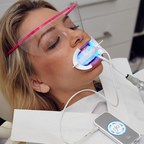 GLO Professional Whitening Achieves a 92% Rating from Dental Advisor
