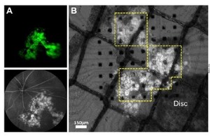 New Mouse Models of Retinal Degeneration Enable Transplantation of Retinal Sheets Derived from Human Embryonic Stem Cells