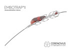 CERENOVUS Receives FDA Clearance For Next Generation Stent Retriever Device Used To Treat Ischemic Stroke