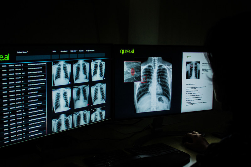 Qure.ai's Chest X-ray product (PRNewsfoto/Qure.ai)