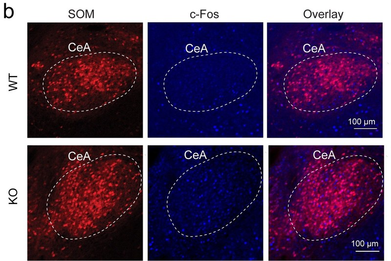 Anxiety was traced by the CSHL team to the brain's central amygdala, and to increased excitation of neurons that express the peptide somatostatin (SOM+ neurons). This initial step is demonstrated in these images, by comparing the amount of pink and blue fluorescence in the bottom right frame as compared with the frame directly above it, showing the central amygdala in mice not experiencing anxiety.