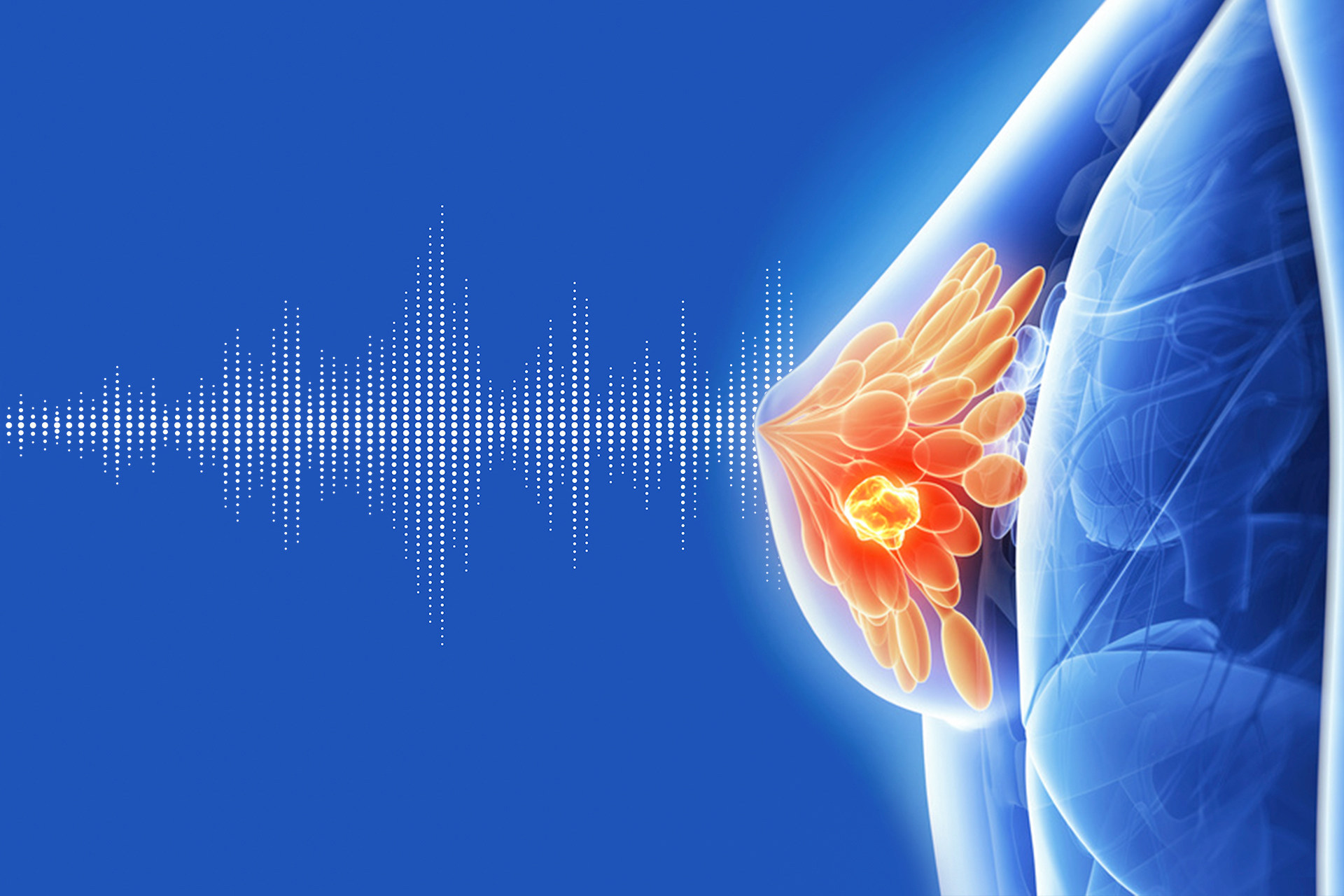 3D Ultrasound Holography
