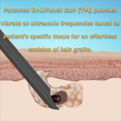 The Ultrasonic Dr.UPunch Curl™ innovates on its predecessor by vibrating at a frequency which is tuned to the patient's skin tissue for an effortless excision.