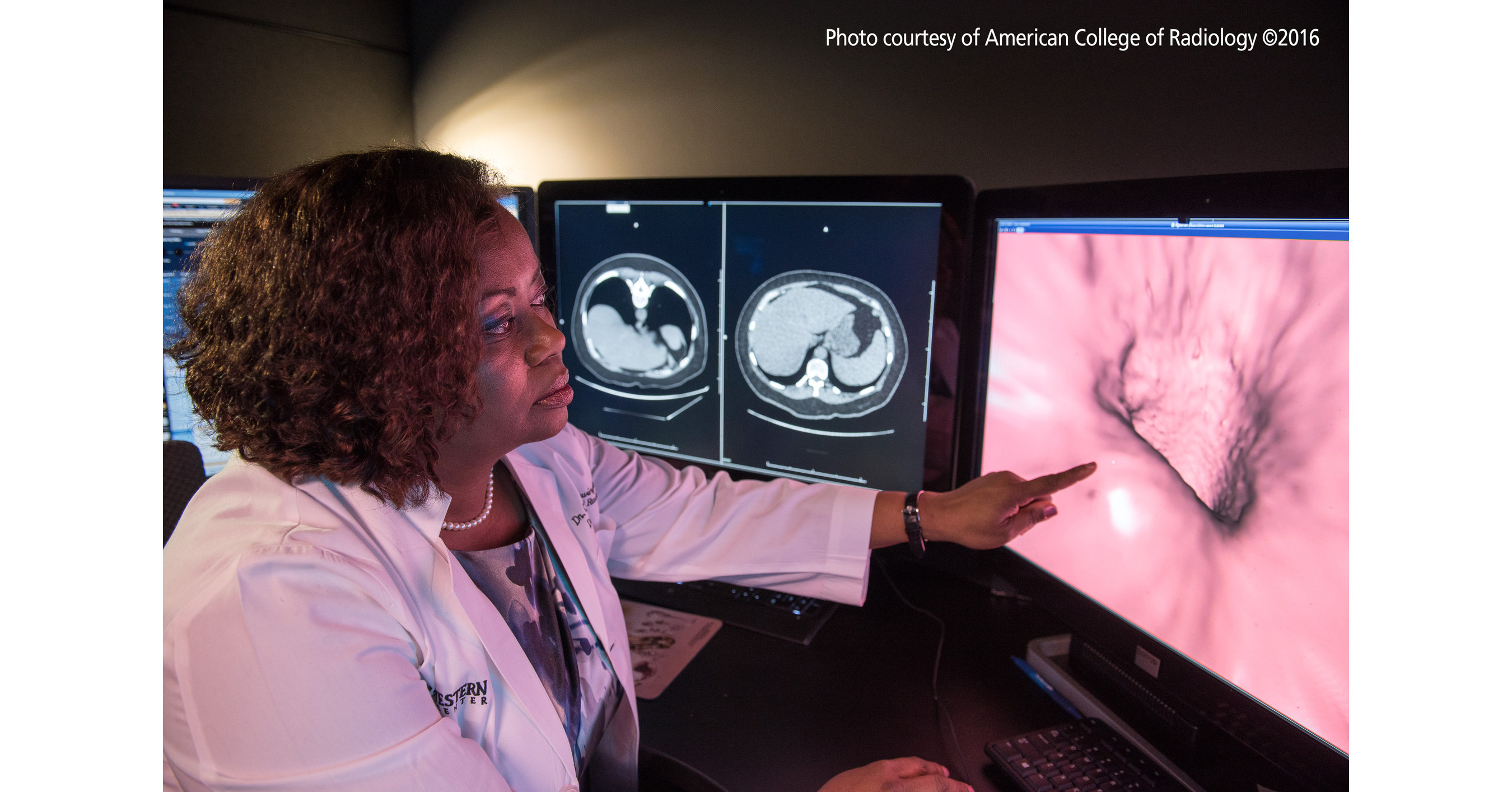 ACR Virtual Colonoscopy Can Attract Younger Americans to