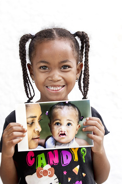 SMILE (CNW Group/Operation Smile Canada)