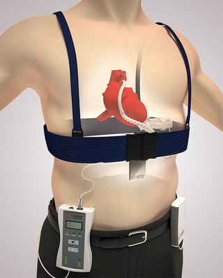 Leviticus Cardio's wireless Coplanar Energy Transfer (CET) system, powers Ventricular Assist Devices (VADs) used to support patients with heart failure