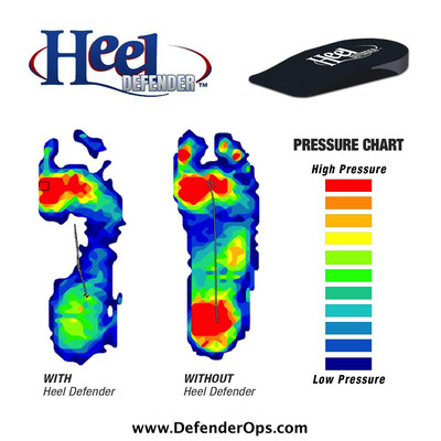 Heel Defender Orthotic Insoles are most effective at reducing pressure on the heel, and have been chosen for a clinical trial of a new treatment for achilles tendonitis.