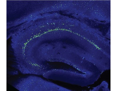 Researchers disabled memory formation in mice by removing the shuttle protein gamma-CaMKII. Selective replacement of the missing protein in nerve cells of a key brain region (the hippocampus, labeled green) resulted in a full recovery of the ability to memorize