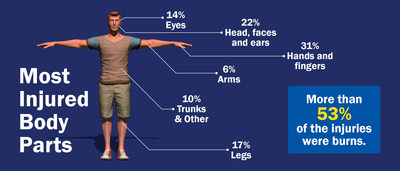 English - Most Injured Body Parts