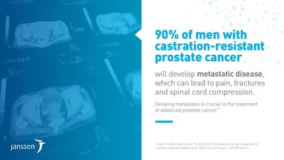 Impact of non-metastatic castration-resistant prostate cancer (CNW Group/Janssen Inc.)