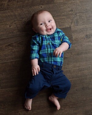 July is National Cleft and Craniofacial Awareness Month