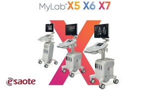 ESAOTE presenta los sistemas de ultrasonidos MyLab™X7, MyLab™X6 y MyLab™X5