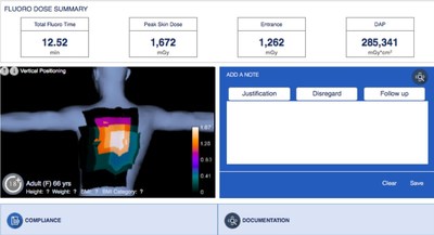 Calculate peak skin dose instantly with Imalogix