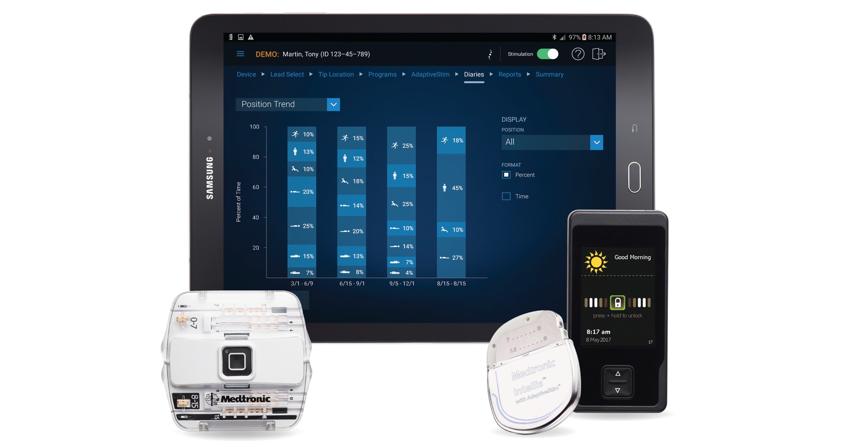 intellis-the-next-generation-medtronic-spinal-cord-stimulator-for