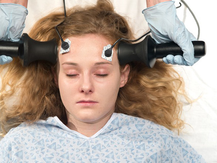 Cchr Ban Needed On Torturous Electroconvulsive Therapy