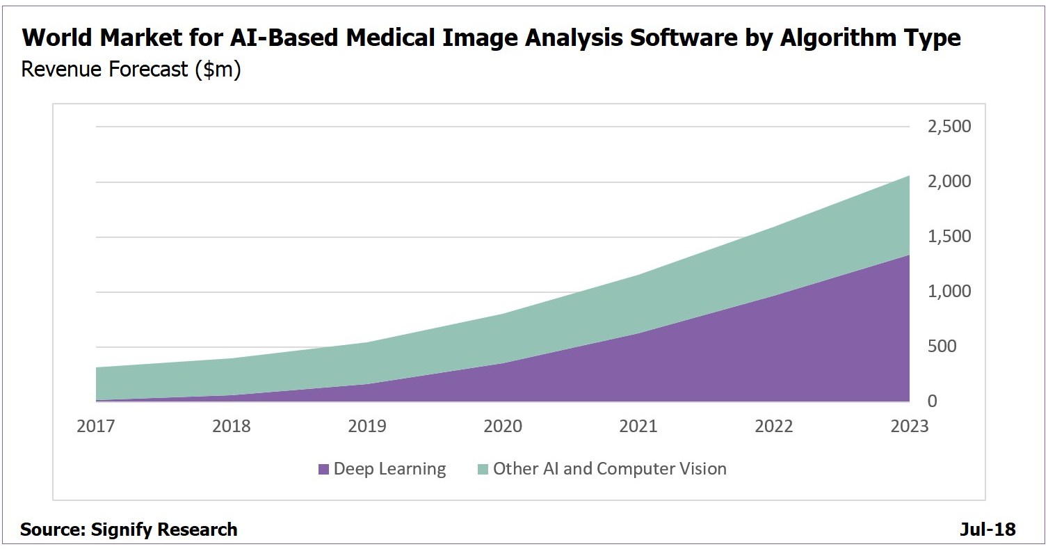 AI in Medical Imaging to Top 2 Billion by 2023