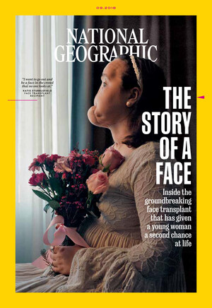 "The Story of a Face": National Geographic Unveils Youngest Full-Face Transplant Recipient in American History