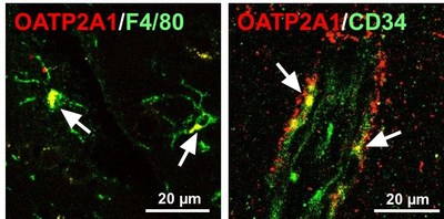 Figure 2 Immunofluorescence for Oatp2a1 in mice glial (left) and endothelial cells (right) in the brain. Immunoreactivity of Oatp2a1 (red color) was detected in F4/80-positive cells (e.g. microglia, green color) and in endothelial cells stained with CD34 (green color). White arrow indicates merge of fluorescence. (PRNewsfoto/Kanazawa University)