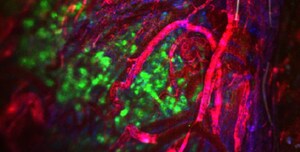 Biotech Investment Opportunity on the VENTURE.co Platform