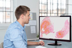 Philips introduces computational pathology software for automated prostate and ovarian tumor detection at ECP 2018