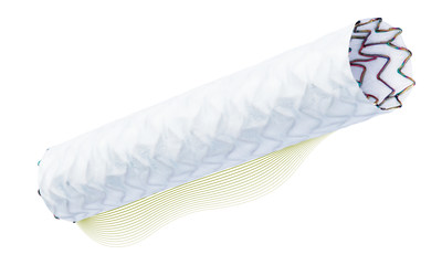 Built on BIOTRONIK's ultrathin stent platform, PK Papyrus is the first FDA approved device for the treatment of acute perforations of native coronary arteries and coronary bypass grafts in vessels 2.5 to 5.0 mm in diameter.