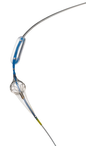 Contego Medical Receives 510(k) Clearance for the Paladin Carotid PTA Balloon System with Integrated Embolic Protection