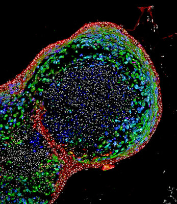 This confocal microscopic image shows a two-month-old human esophageal organoid bioengineered by scientists from pluripotent stem cells. About 700 micrometers (0.027 inches) in size, the organoid is stained to visualize key structural proteins expressed in mature esophagus, such as involucrin (green) and cornulin (blue). Researchers report in the journal Cell Stem Cell the organoids enhance the study of esophageal disorders and personalized medicine.