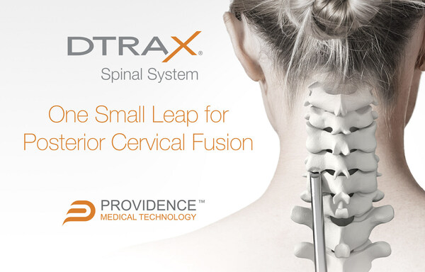 DTRAX® Spinal System from Providence Medical Technology, Inc. is a set of instruments indicated to be used to perform posterior cervical fusion in patients with cervical degenerative disc disease.