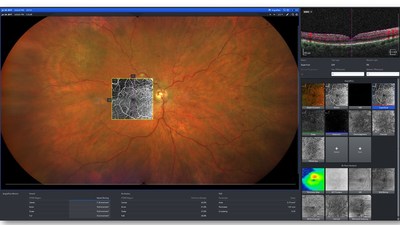 Integrated Diagnostic Imaging for Retina